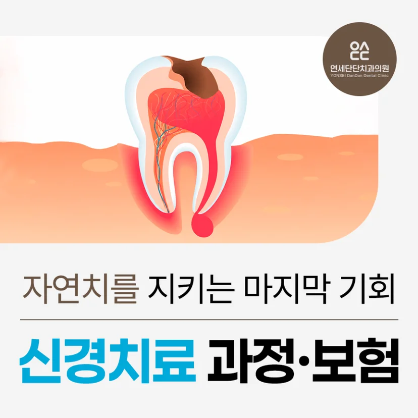 신경치료 표지