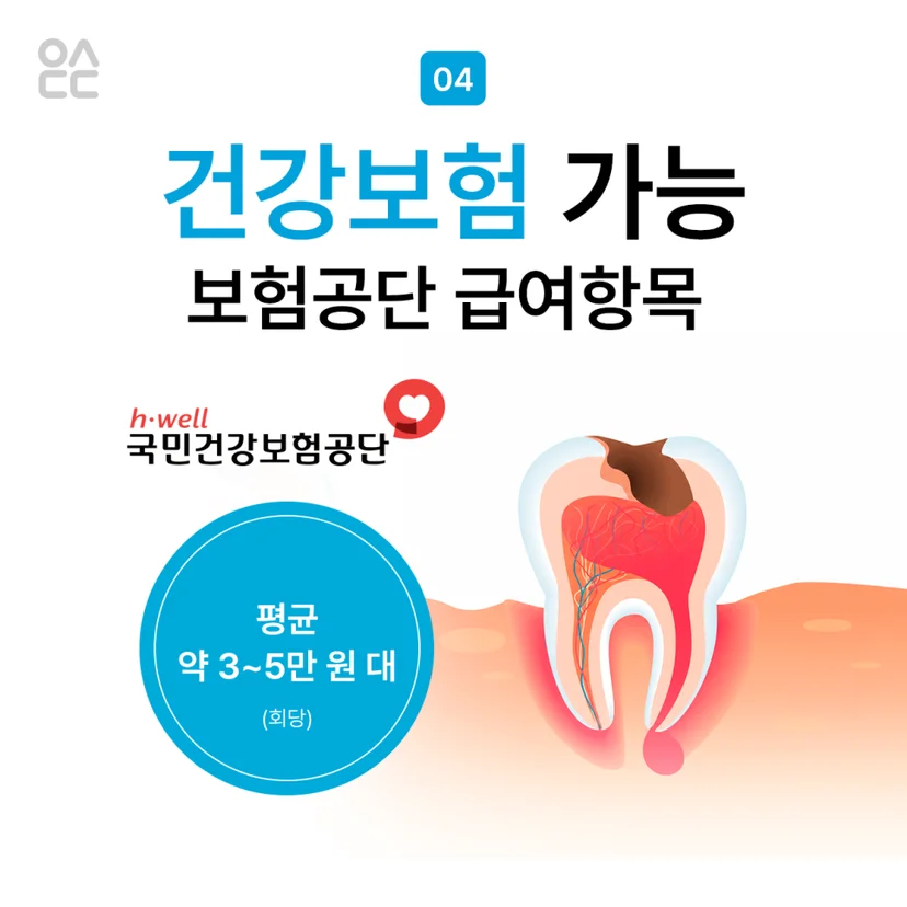 신경치료 건강보험