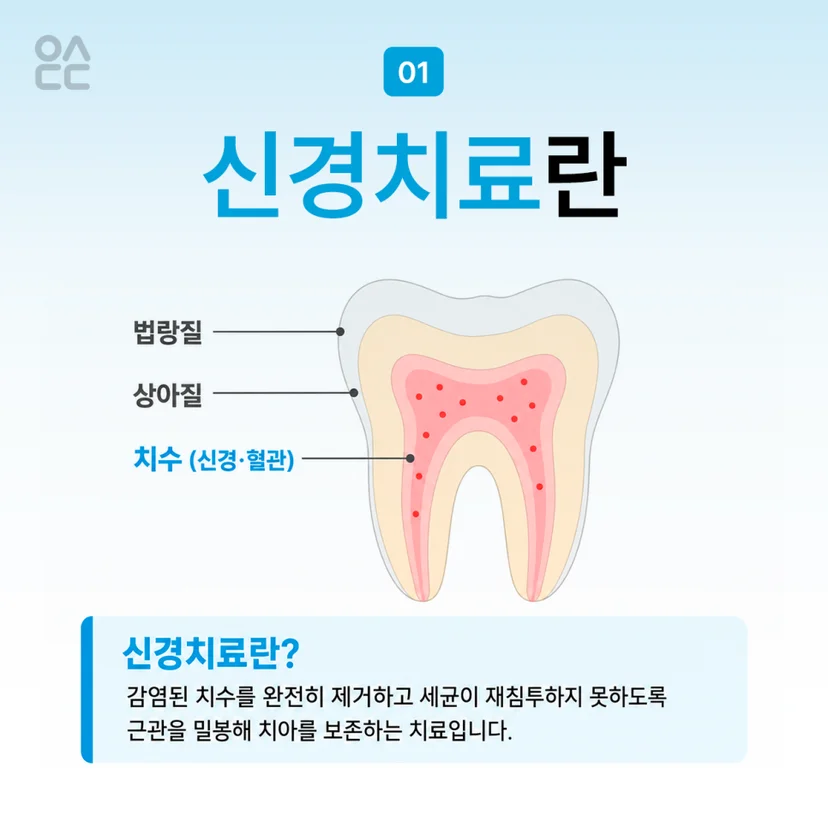 신경치료 설명
