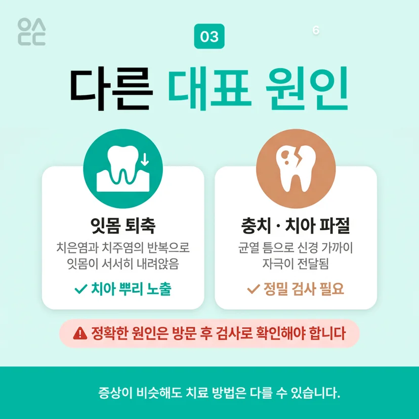 시린이 원인 2