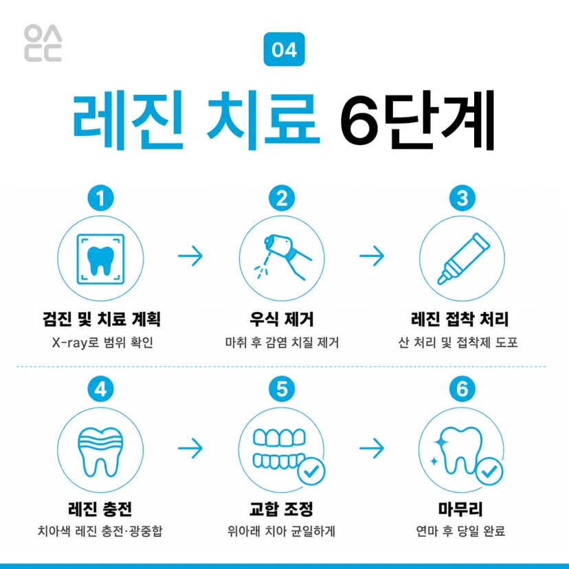 레진 치료 단계