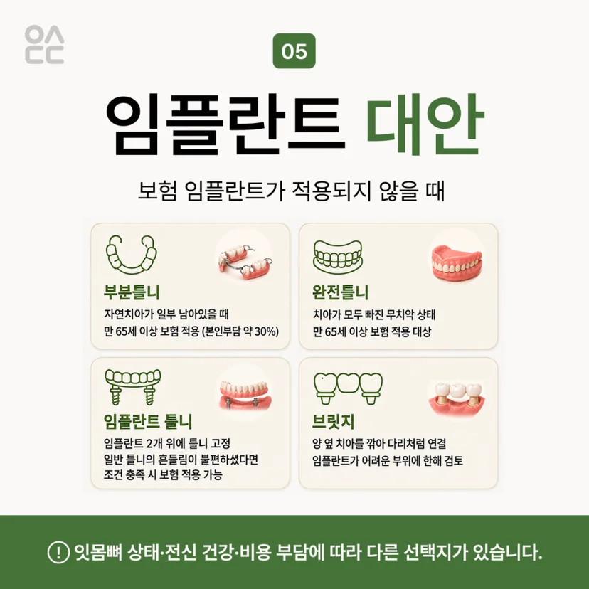 보험 임플란트 대안