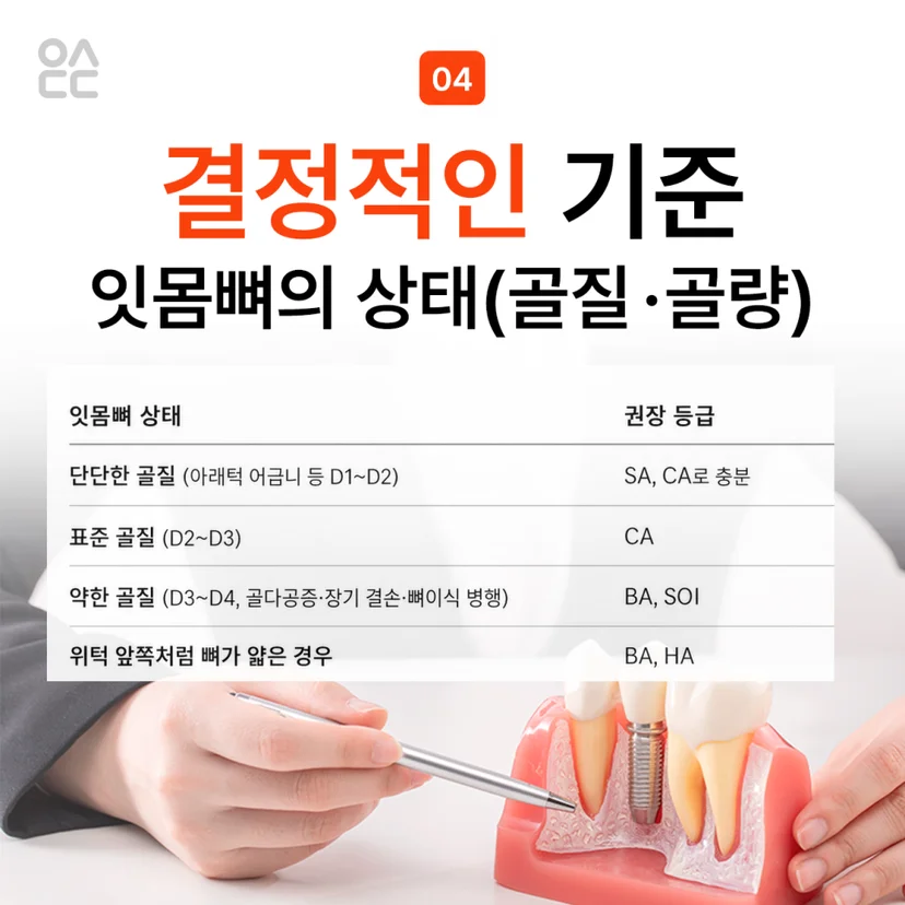 오스템 임플란트 잇몸뼈 기준