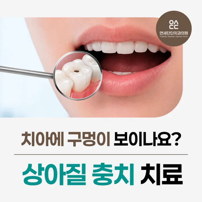 상아질 충치 표지