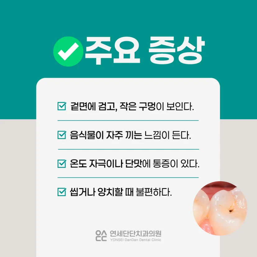 상아질 충치 주요 증상