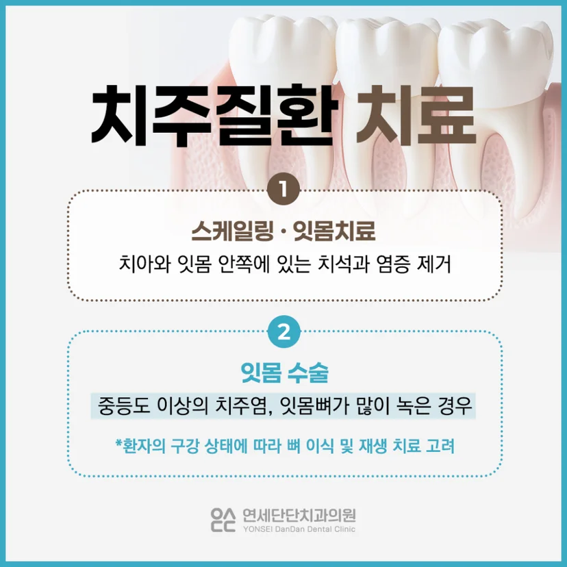 치주질환 질환