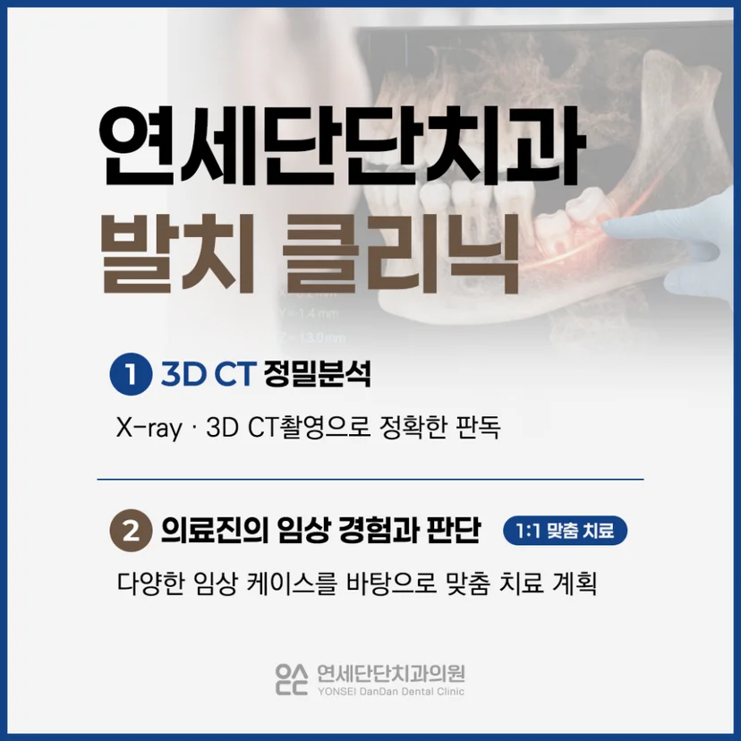 연세단단치과 사랑니 발치