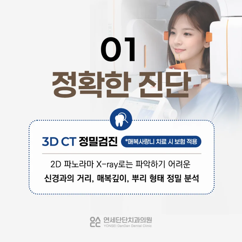 사랑니 발치 치과 선택 기준