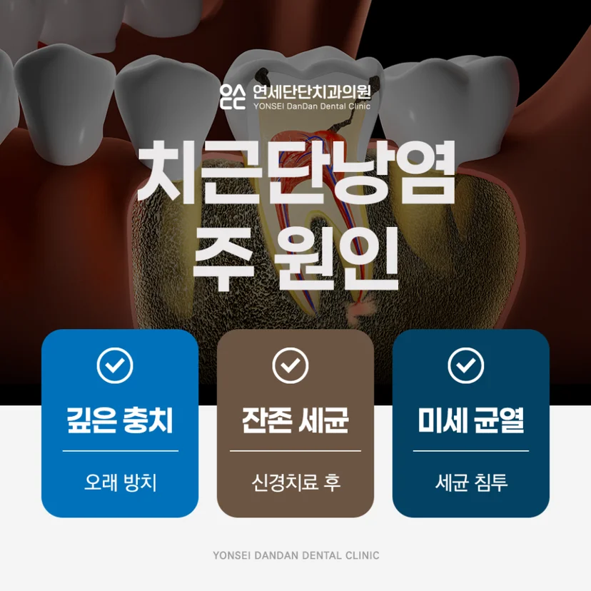 치근단낭염 원인
