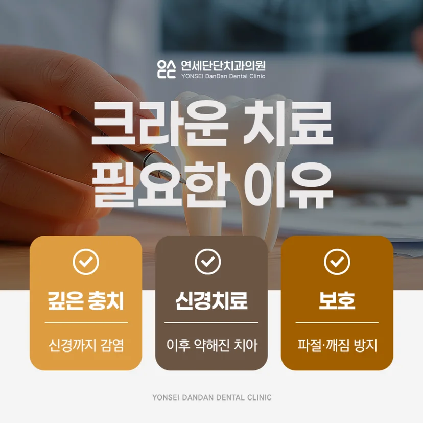 크라운 치료가 필요한 이유