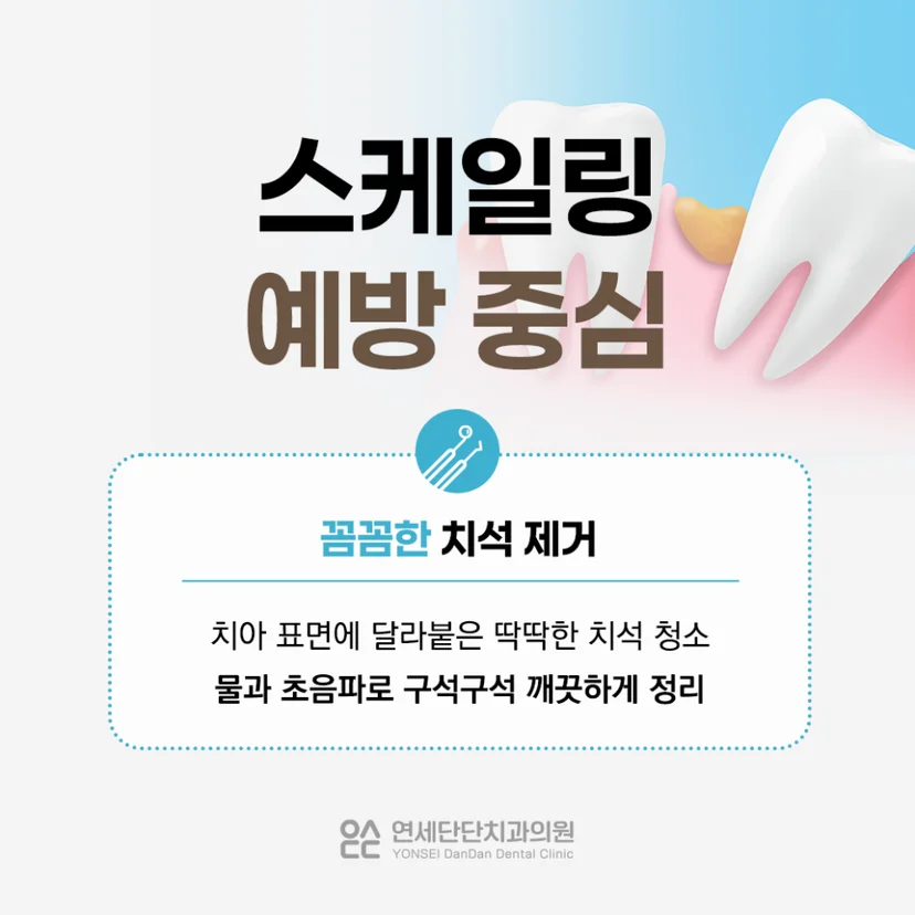 예방 중심인 스케일링