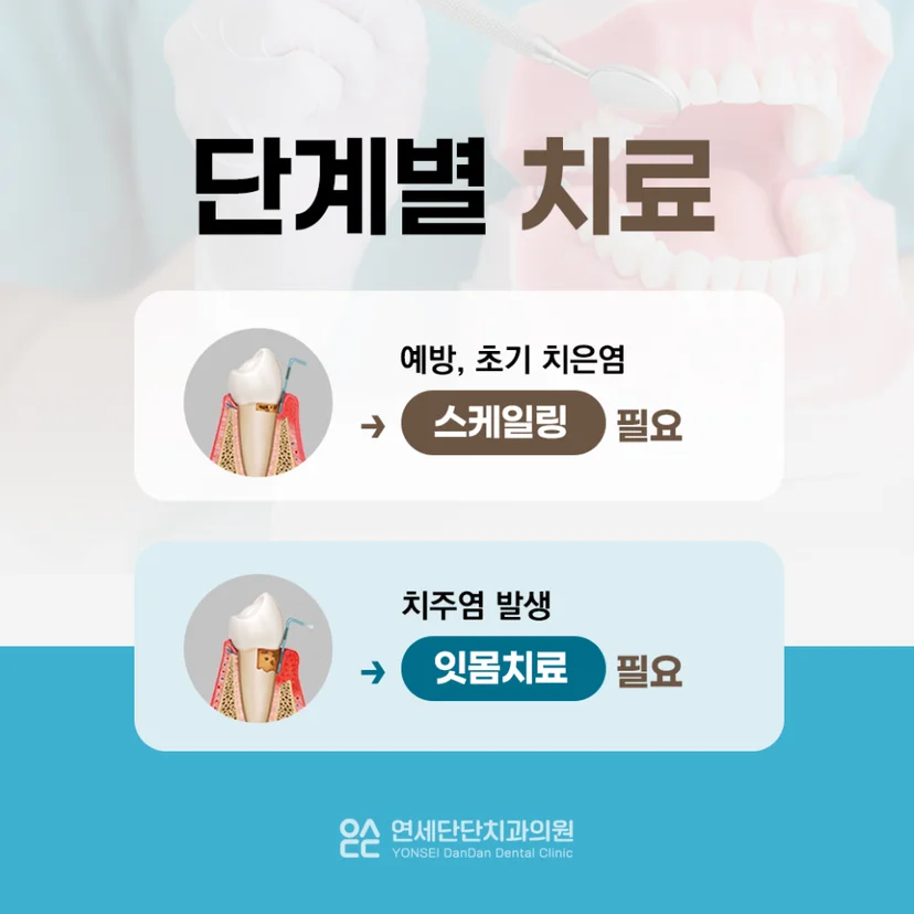 단계별 치료