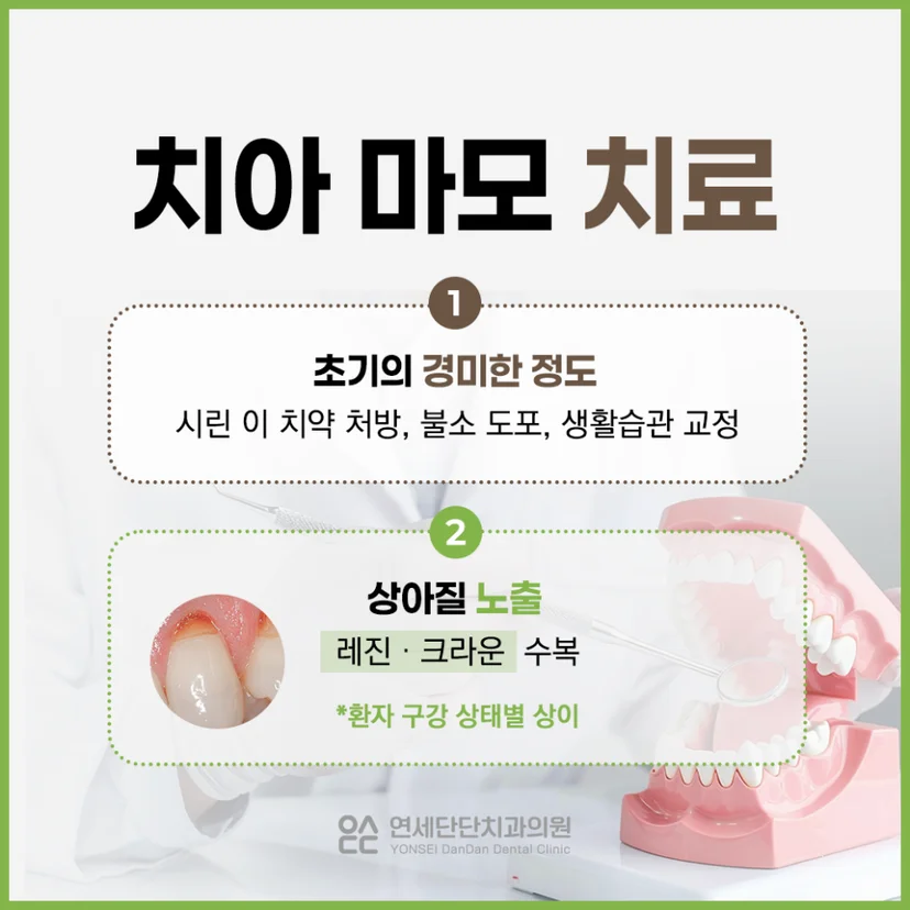 치아 마모 치료