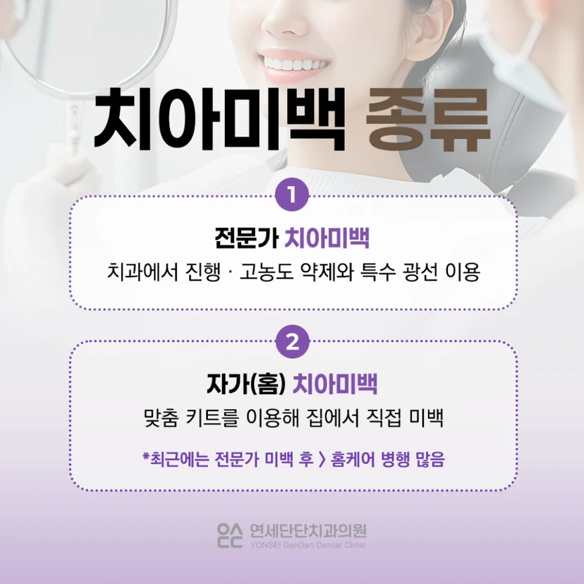 치아미백 종류