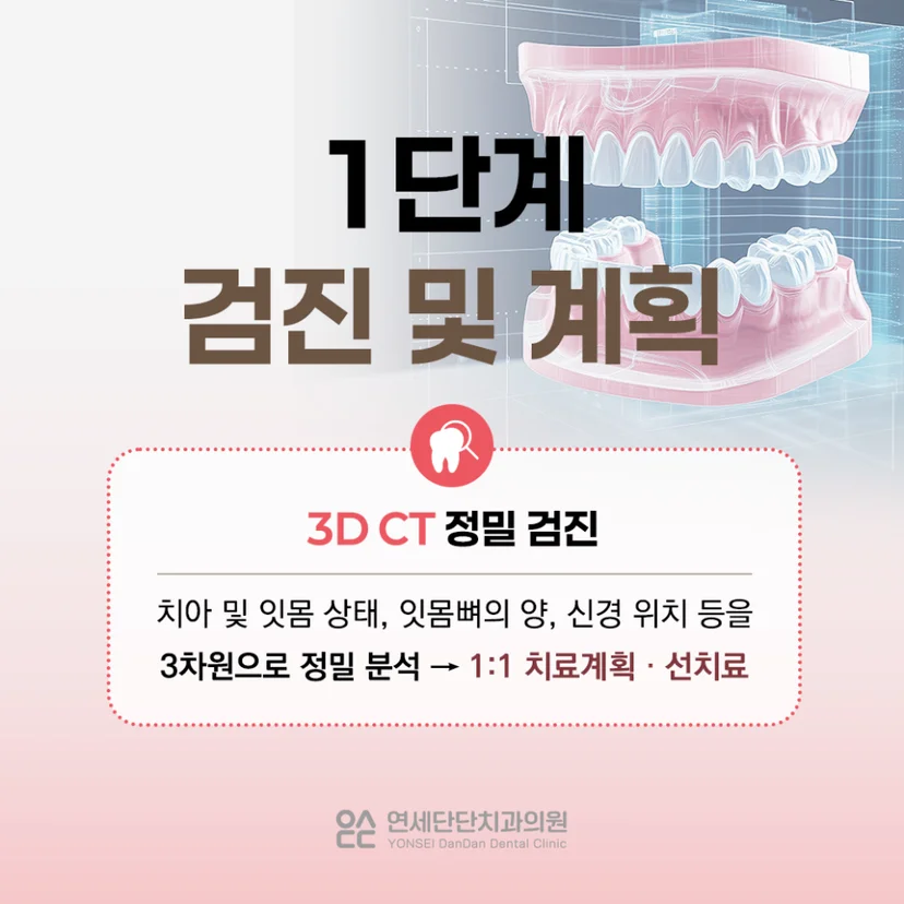 임플란트 단계