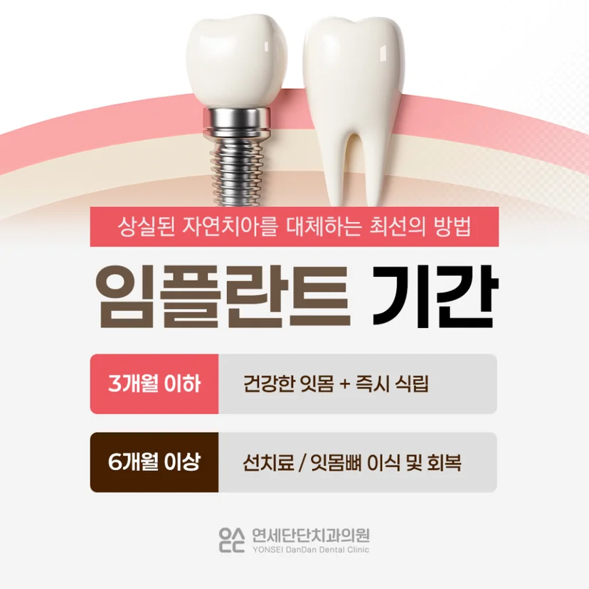 임플란트 치료 기간