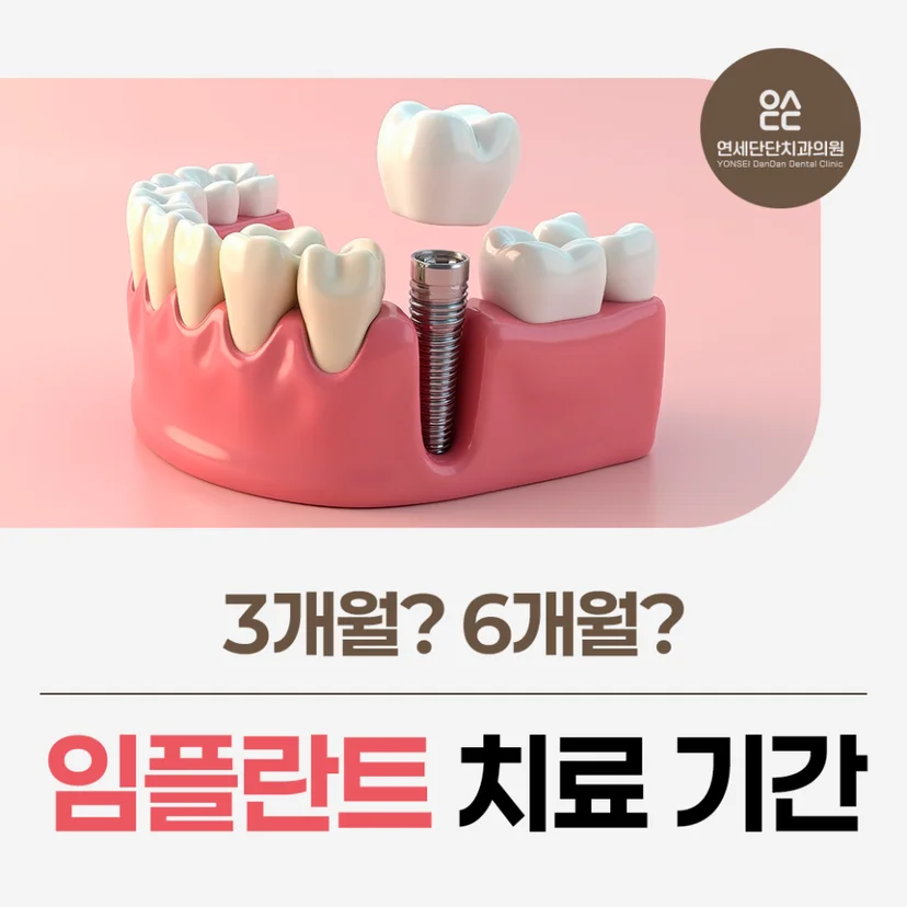임플란트 치료 기간 표지