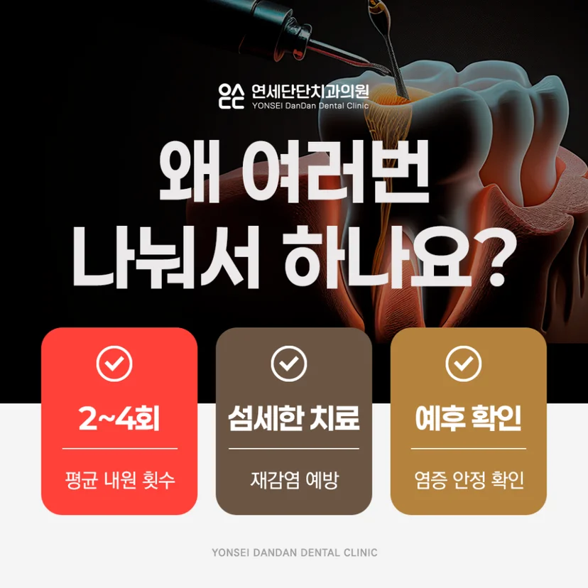 신경치료 과정