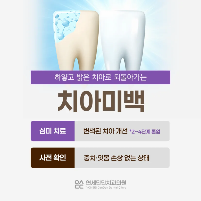 치아미백 알아보기