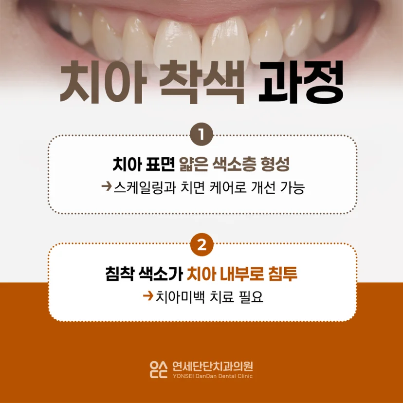 치아 착색 과정