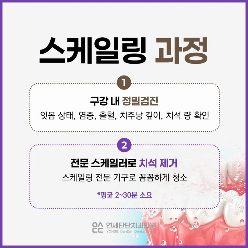 스케일링 과정