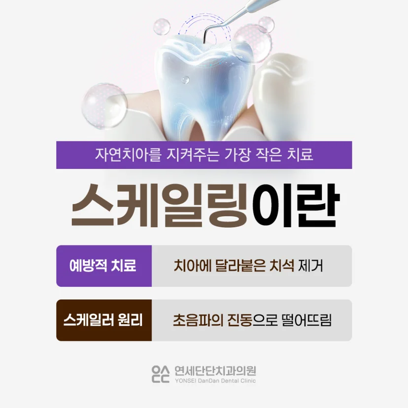 스케일링 설명
