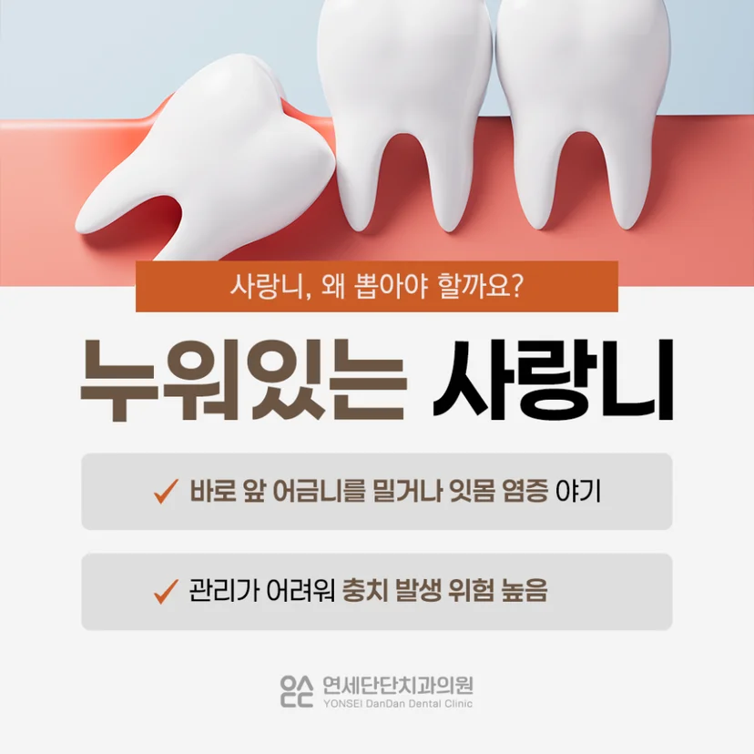 누워있는 사랑니 발치 