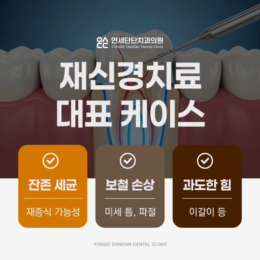 재신경치료 원인