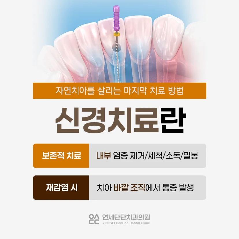 신경치료 설명