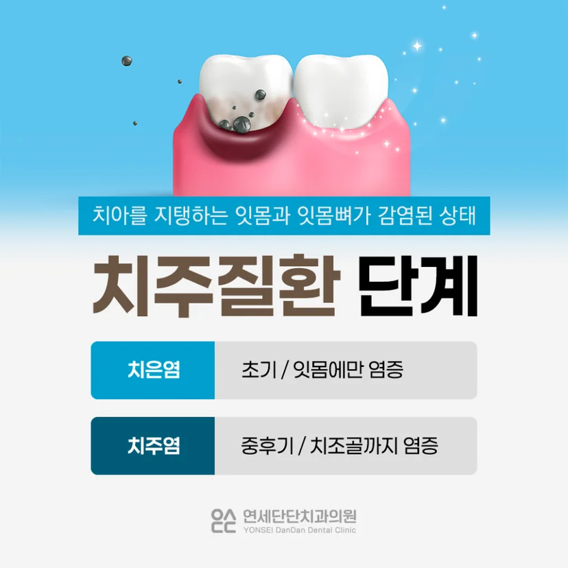 치주질환 단계