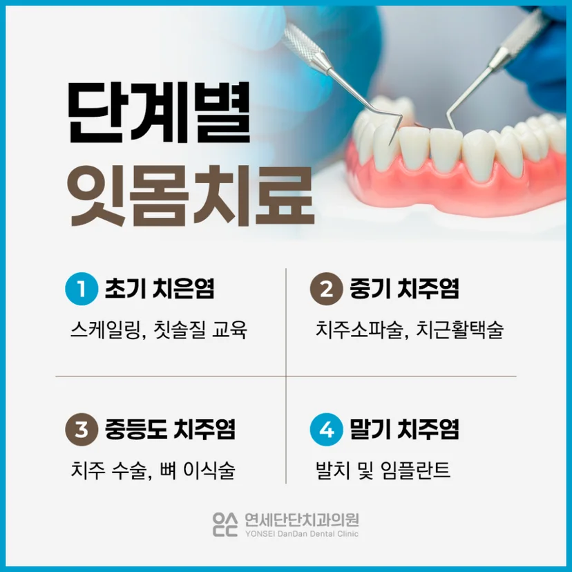 치주질환 단계별 잇몸치료