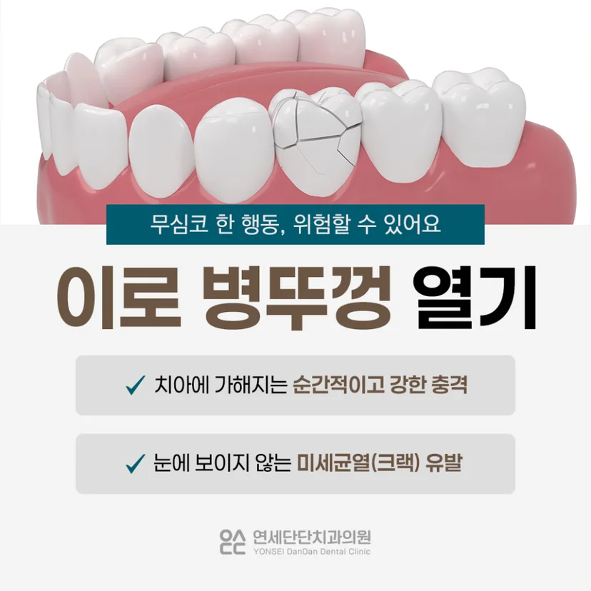 이로 병뚜껑 따기가 위험한 이유