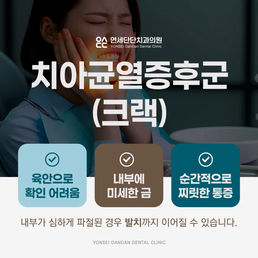 치아균열증후군(크랙)