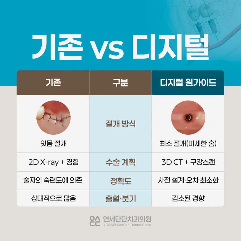 당뇨 임플란트 디지털 원가이드