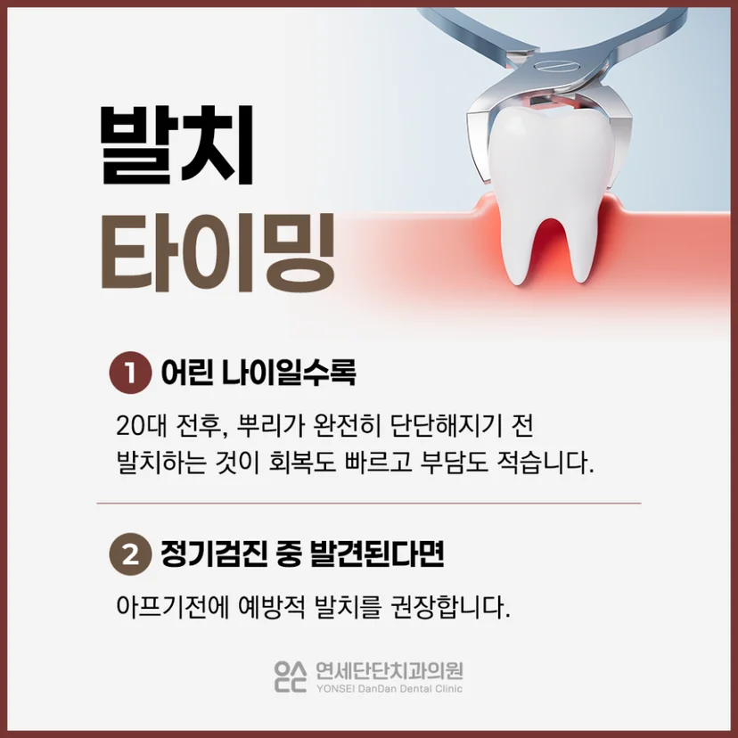 매복 사랑니 발치 시기