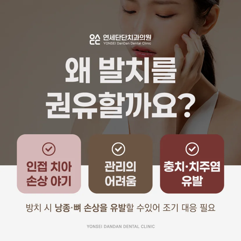 매복 사랑니 발치 필요성