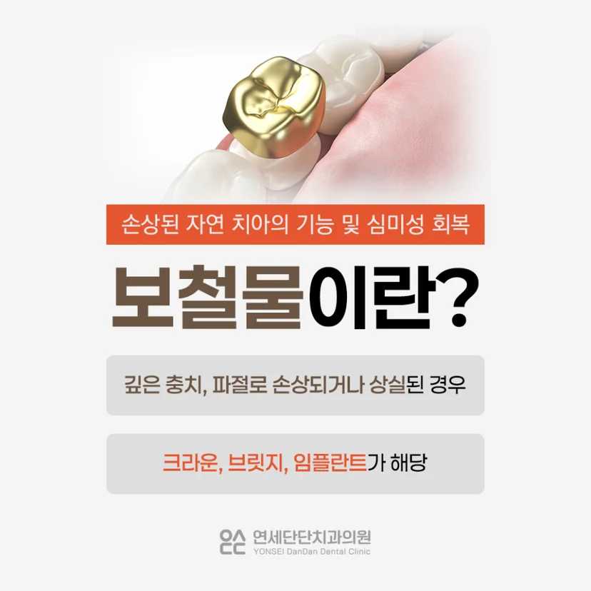 보철물 설명