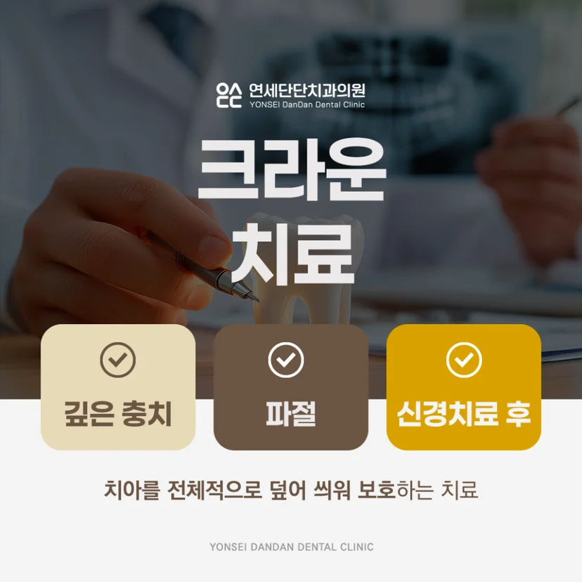 크라운 치료 설명