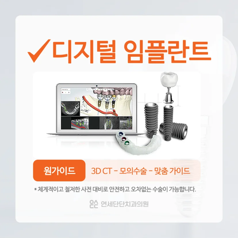 디지털 임플란트