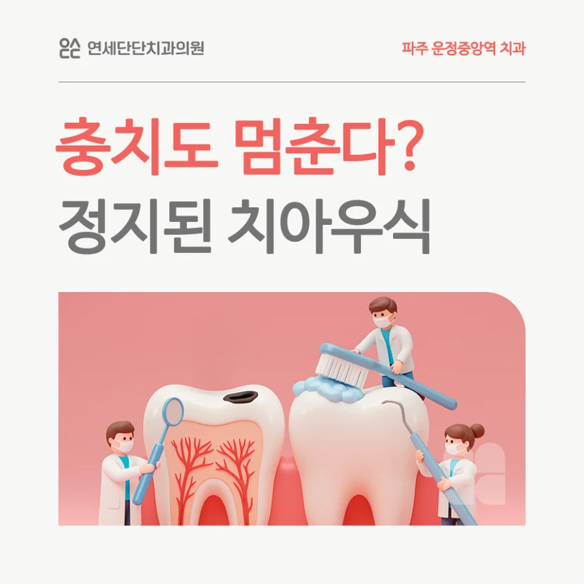 정지된 치아우식 표지