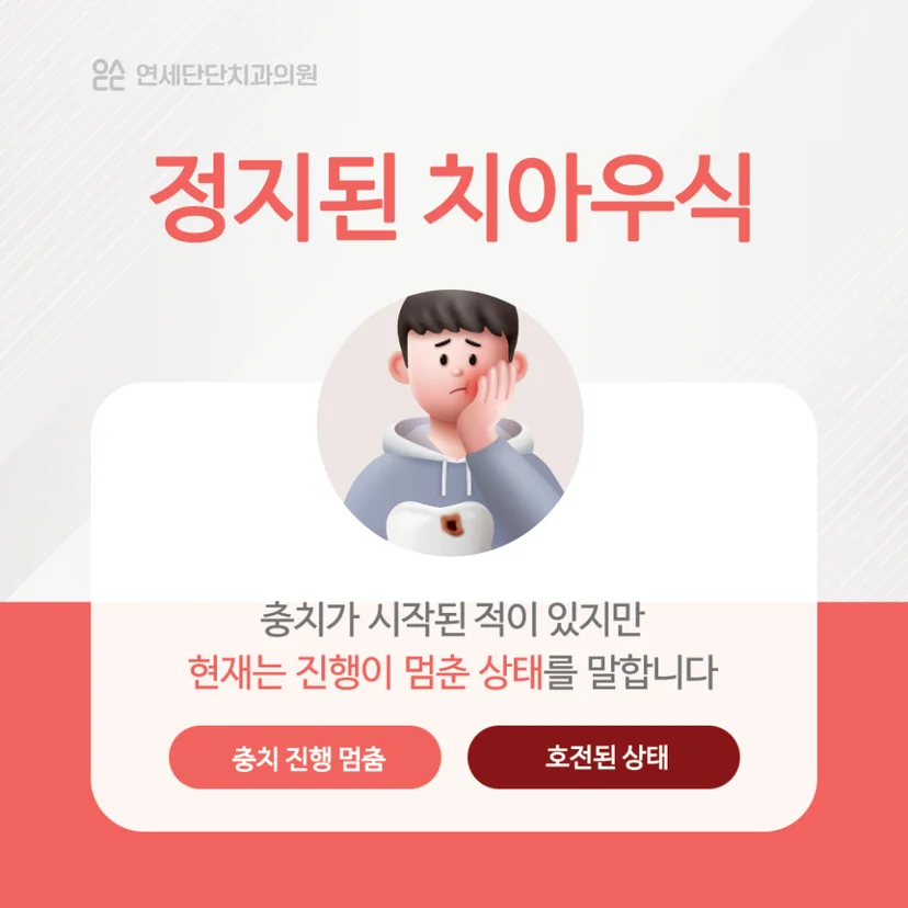 정지된 치아우식 설명