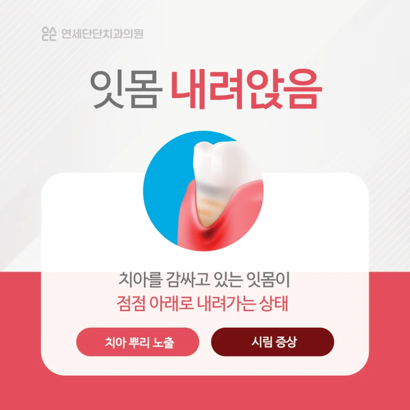 잇몸 내려앉음 설명