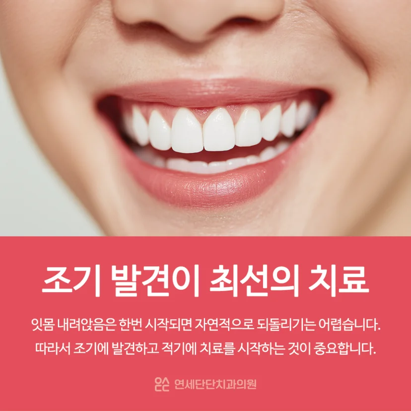 잇몸 내려앉음 조기 발견