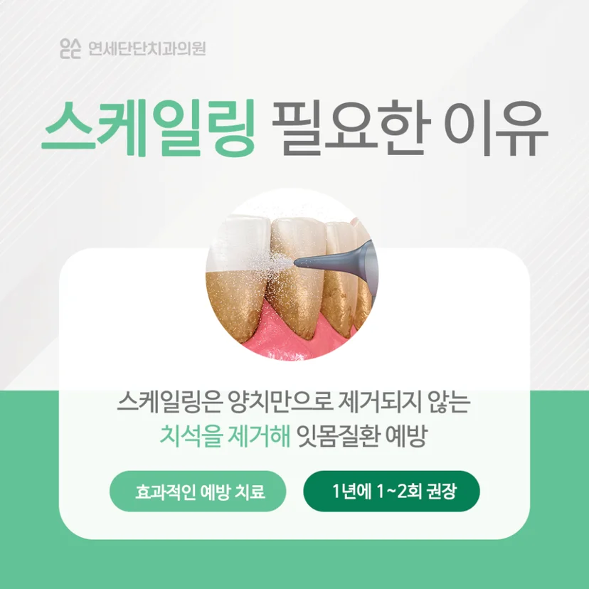 스케일링 필요성