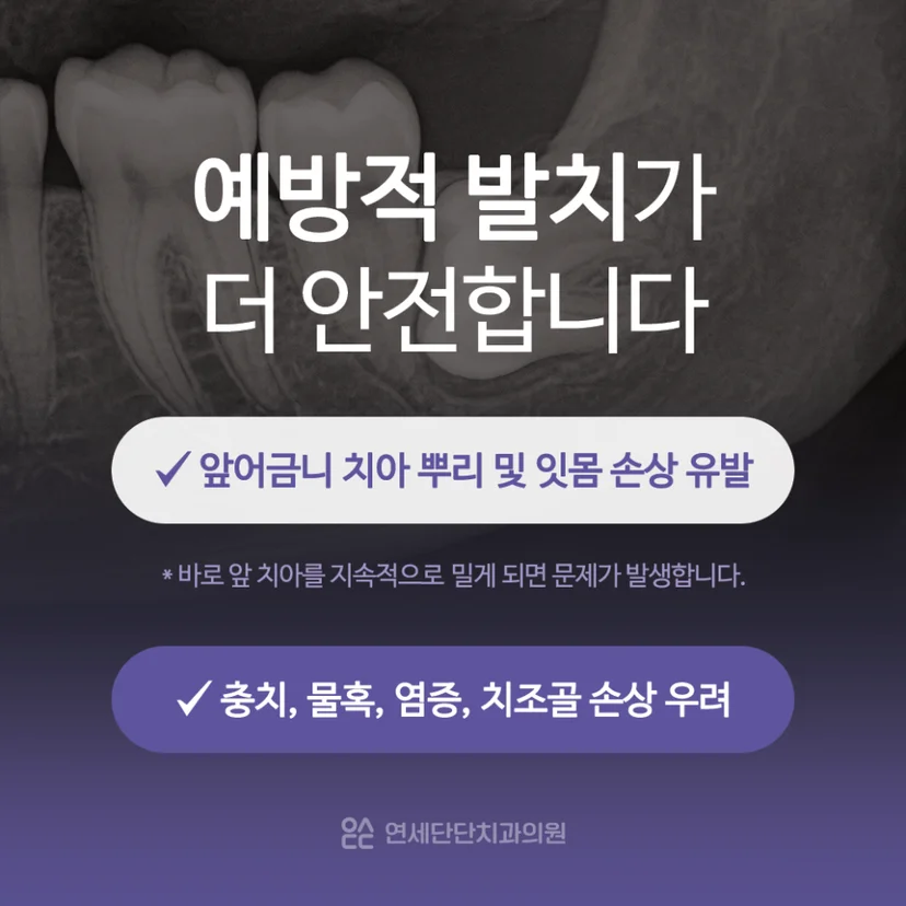 완전매복 사랑니 예방적 발치