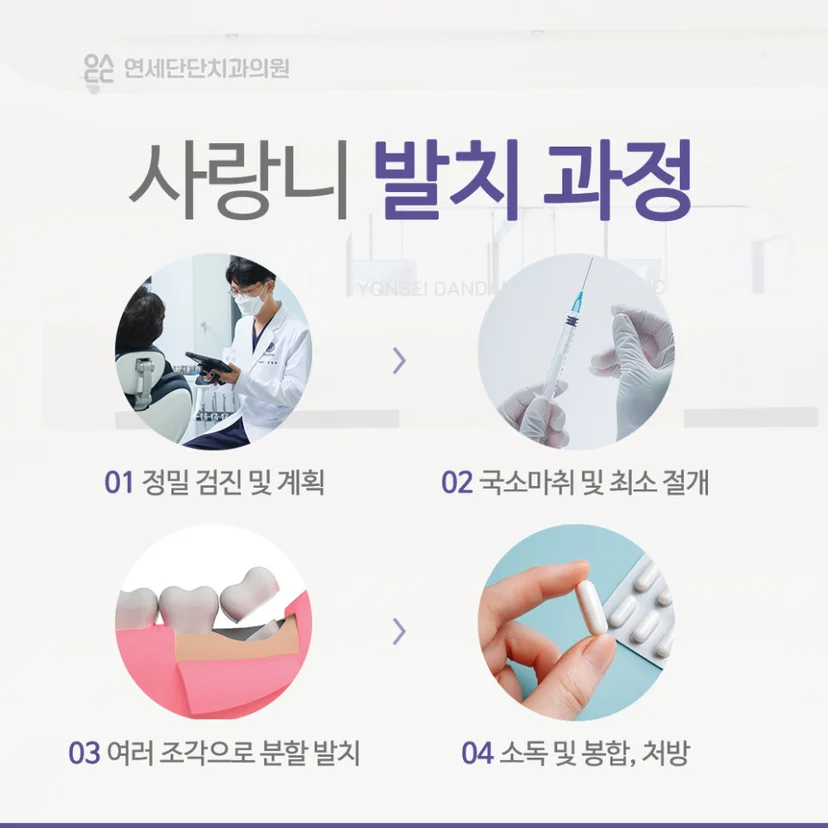 완전매복 사랑니 발치 과정