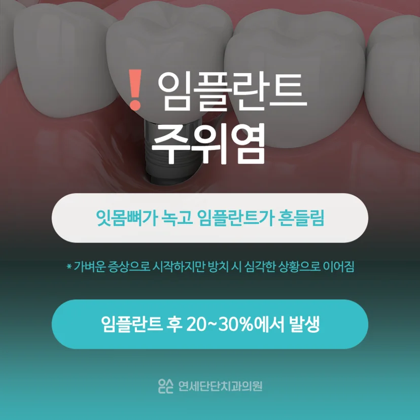 임플란트 주위염 설명