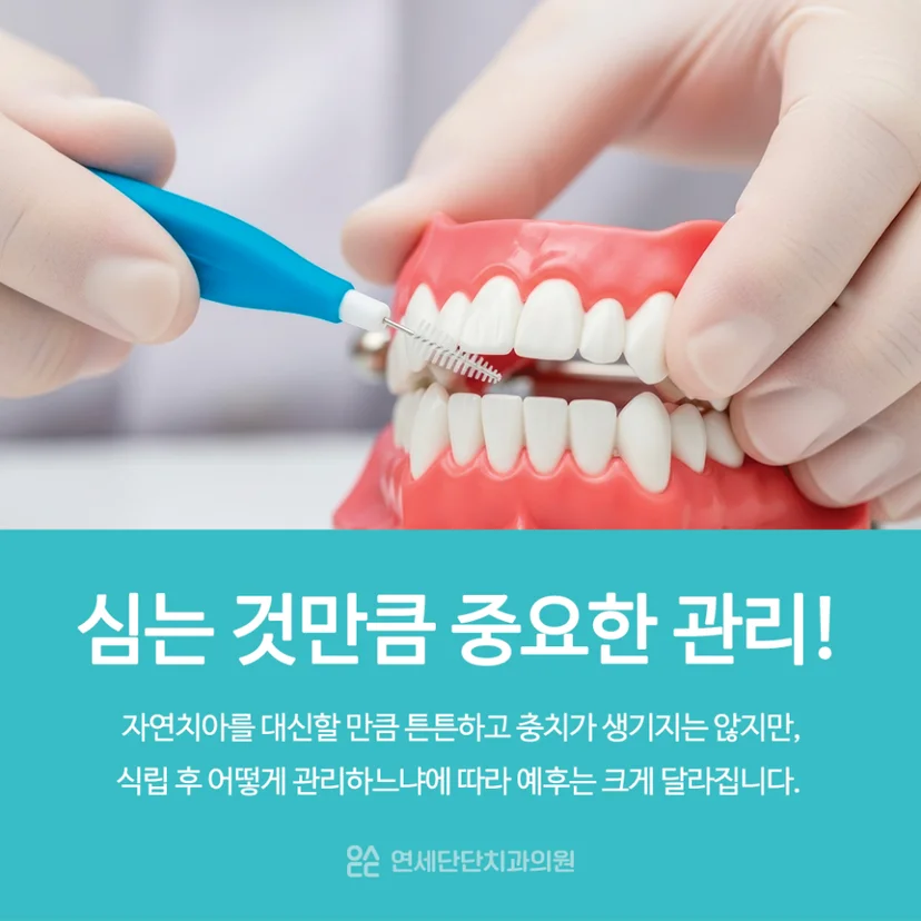 임플란트 관리 중요성