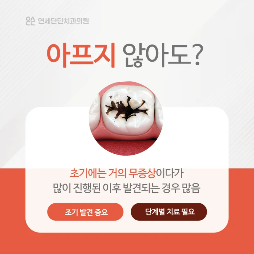 충치치료 조기 진단
