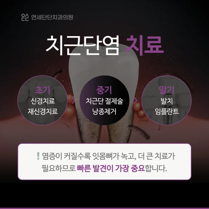 치근단염 치료